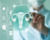 A endometriose é genética? Saiba se você pode ter mais chance de desenvolvê-la - Jornal da Franca
