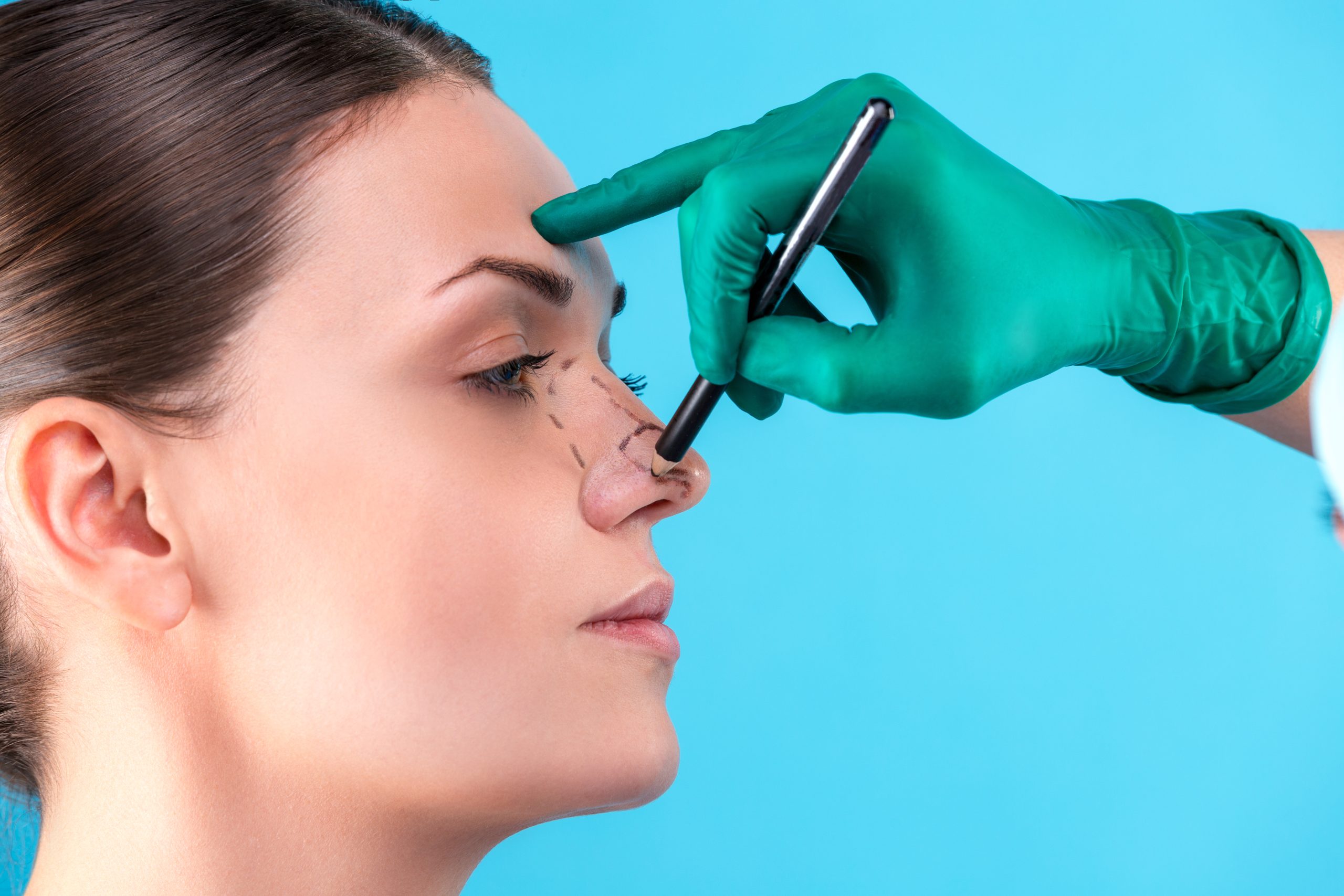 Rinoplastia: veja 4 benefícios do procedimento que vão além da estética