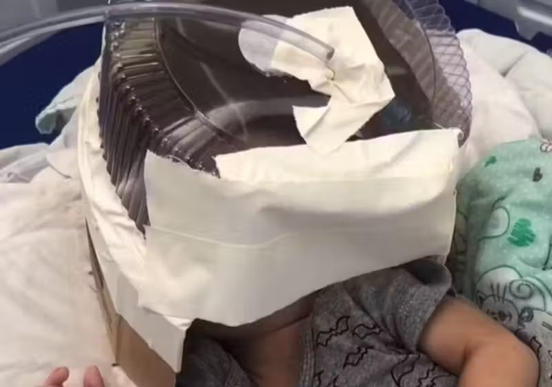 Médica age rápido e usa embalagem de bolo como máscara de oxigênio para salvar bebê