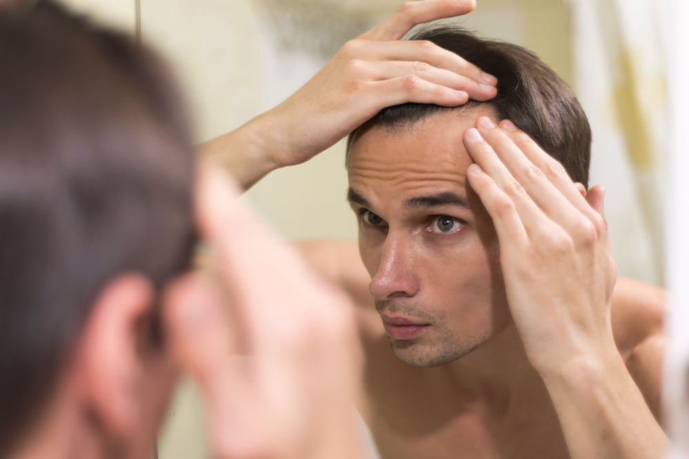 Médico alerta sobre os sinais precoces da calvície masculina e como buscar ajuda