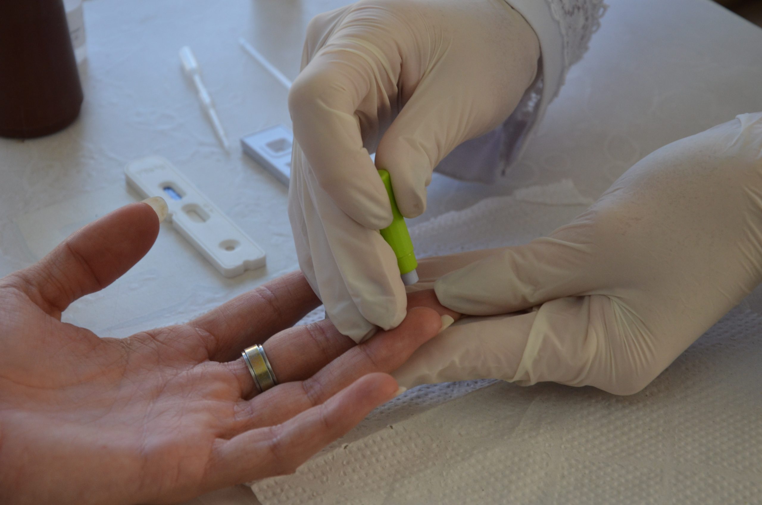 Julho Amarelo: Franca disponibiliza testes rápidos de hepatites durante a semana