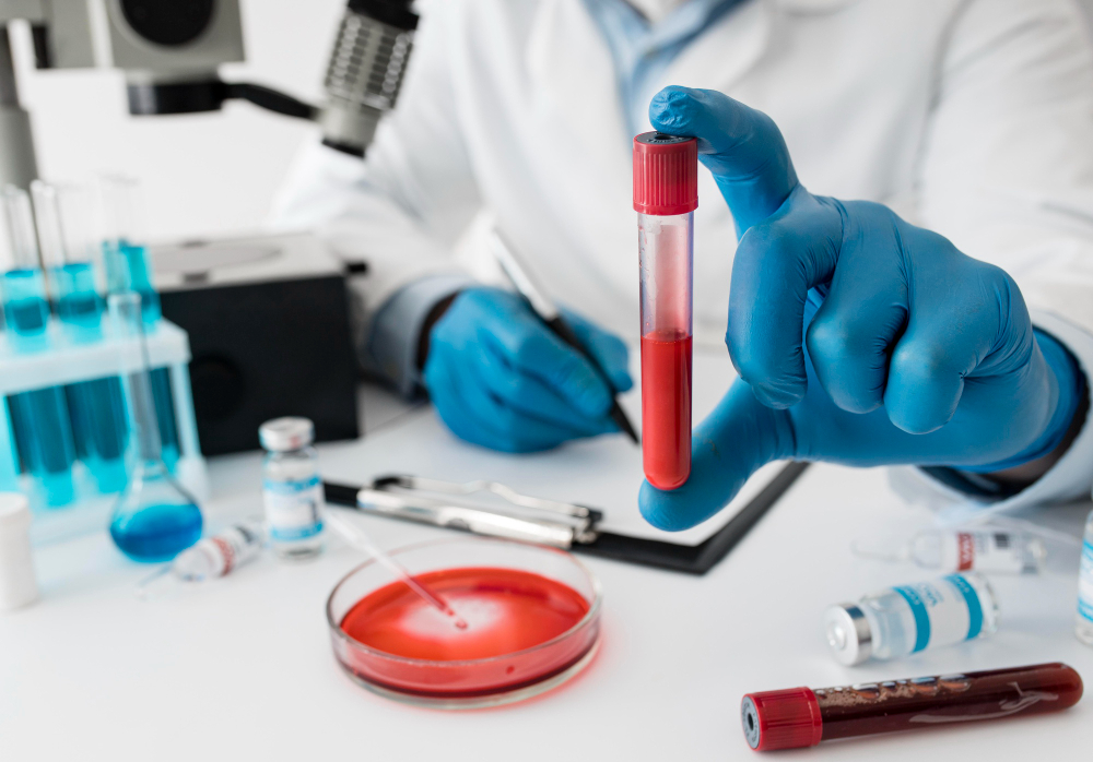 Exames de sangue: especialista desmistifica mitos que envolvem exames laboratoriais