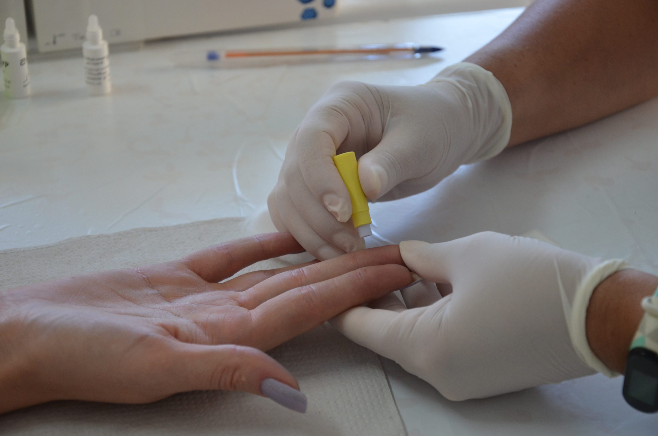 Saúde em foco: Campanha ‘Fique Sabendo’ realiza 599 testes rápidos em Franca