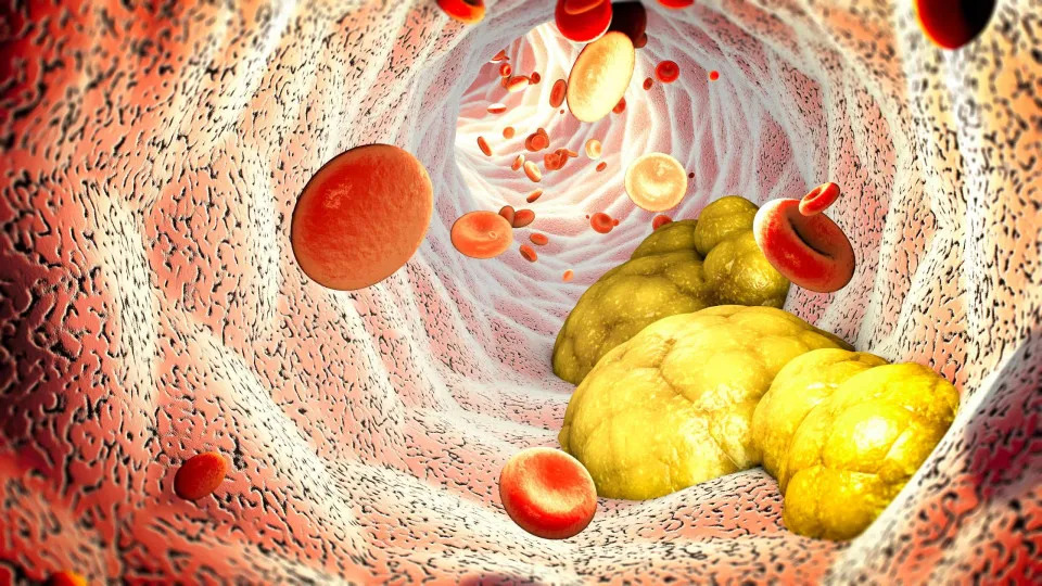 Cientistas descobrem proteína ligada ao colesterol ruim com inteligência artificial