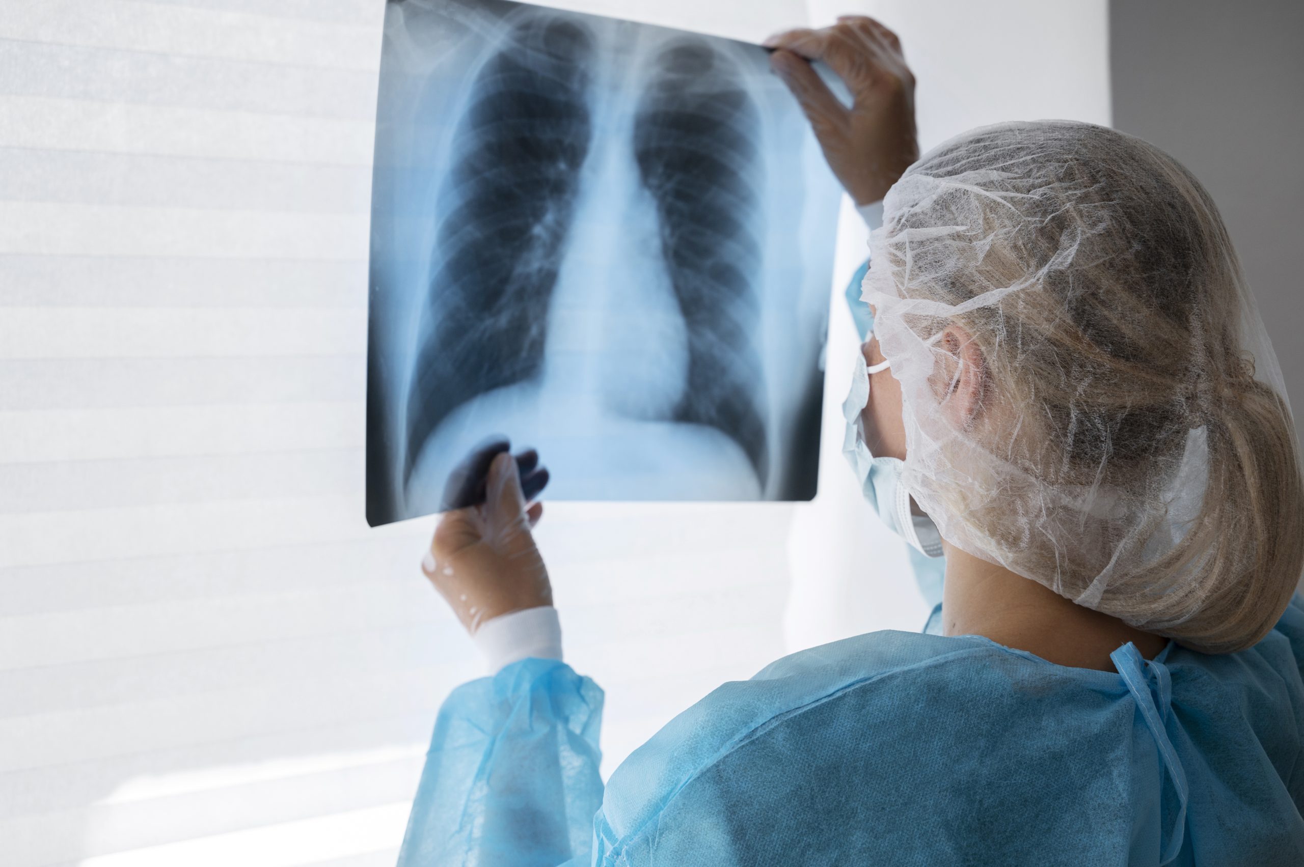 Entenda o que é pneumonia silenciosa, que tem alertado autoridades de saúde