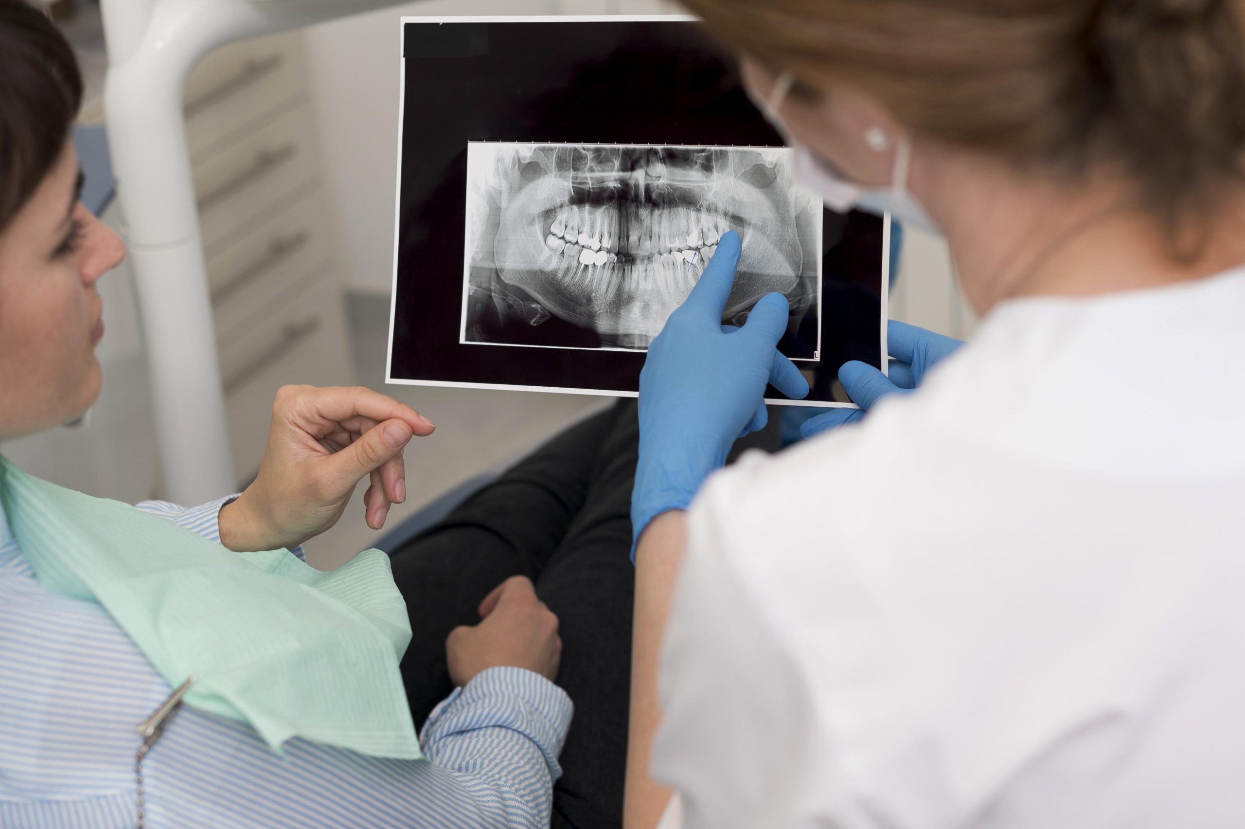 Mitos e verdades sobre os riscos da cirurgia do dente siso