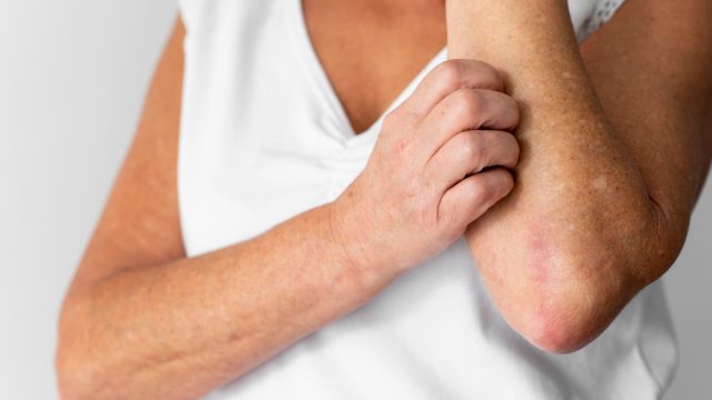 Coceira que não passa e nariz entupido: seu corpo pode estar enfrentando a inflamação tipo 2