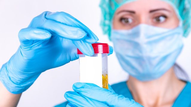 Vai fazer exame médico? Confira 5 fatores que podem alterar os resultados no laboratório