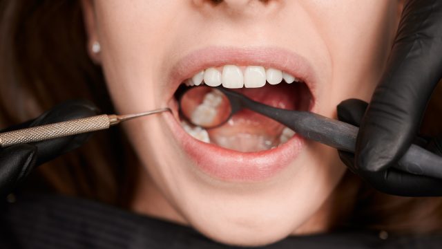Por que algumas pessoas acumulam mais tártaro nos dentes do que outras?